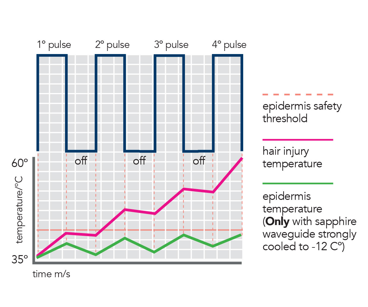 APC (Adaptive Pulse Control)