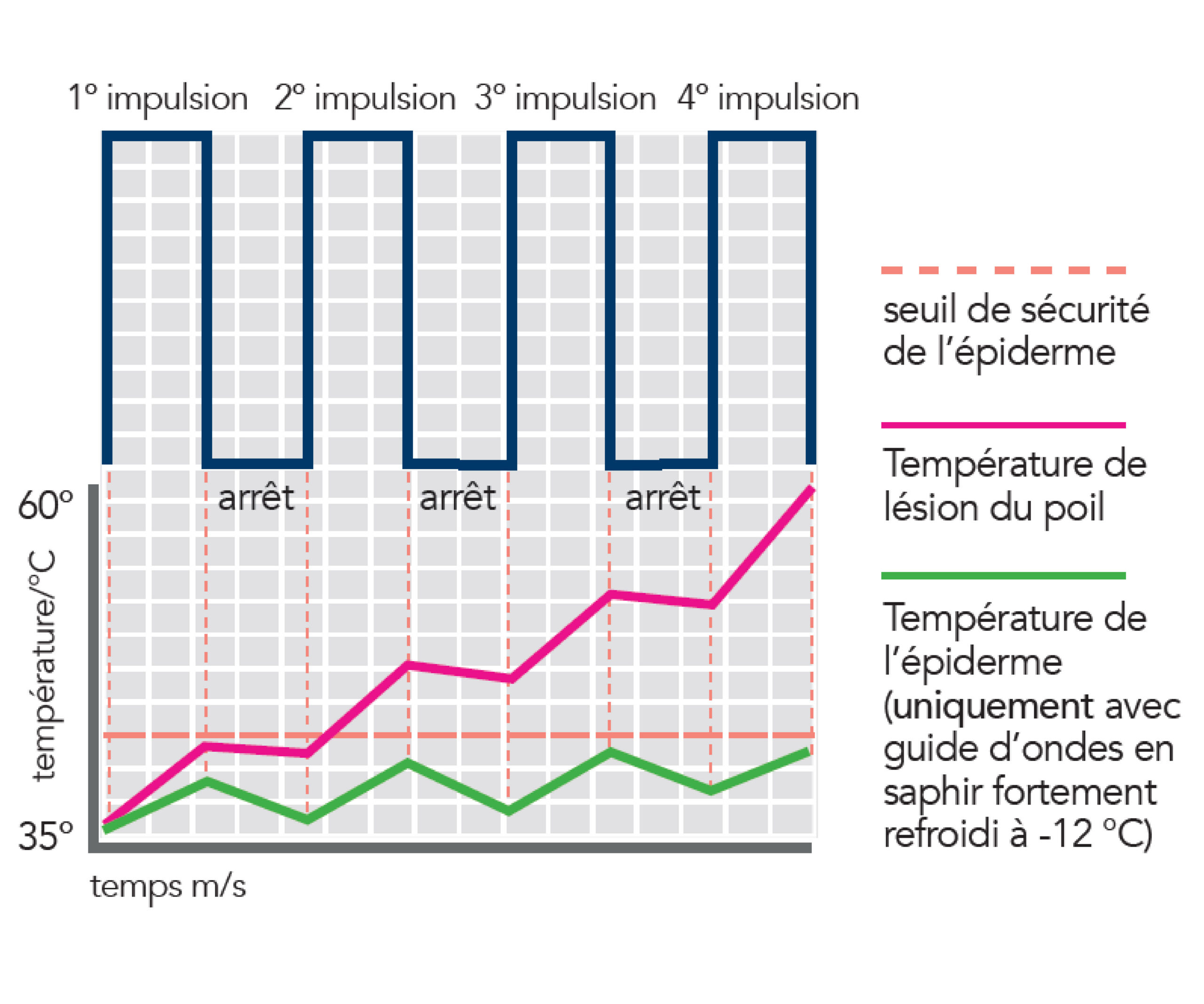 APC (Adaptive Pulse Control)